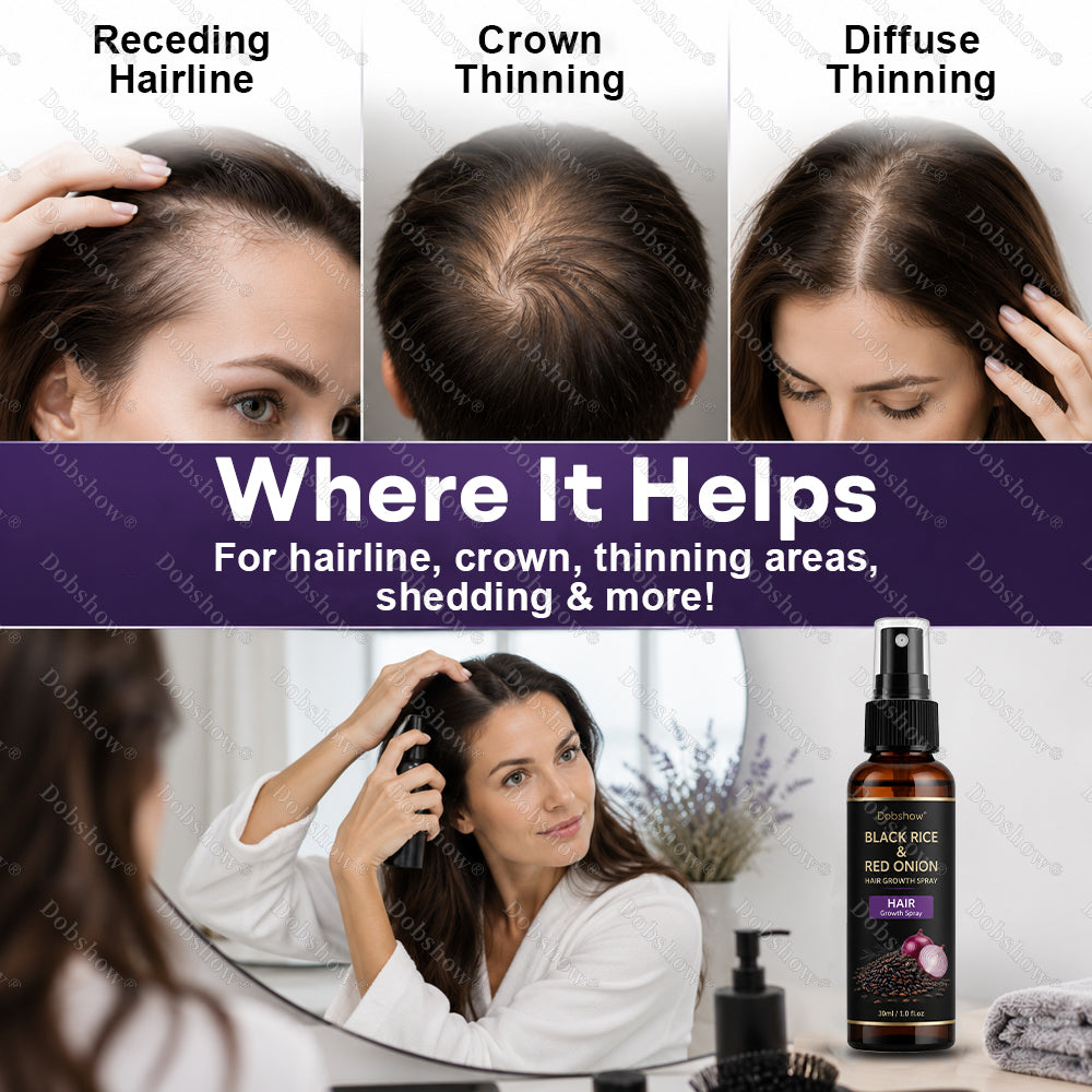 🔥Dobshow® Black Rice & Red Onion Hair Growth Spray