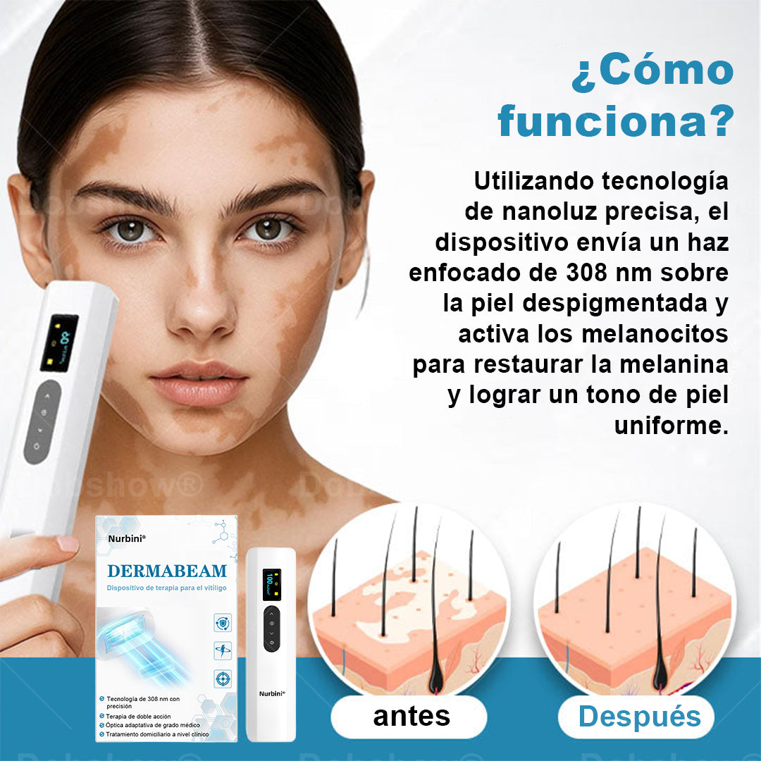 Nurbini® DermaBeam Instrumento para el tratamiento del vitíligo
