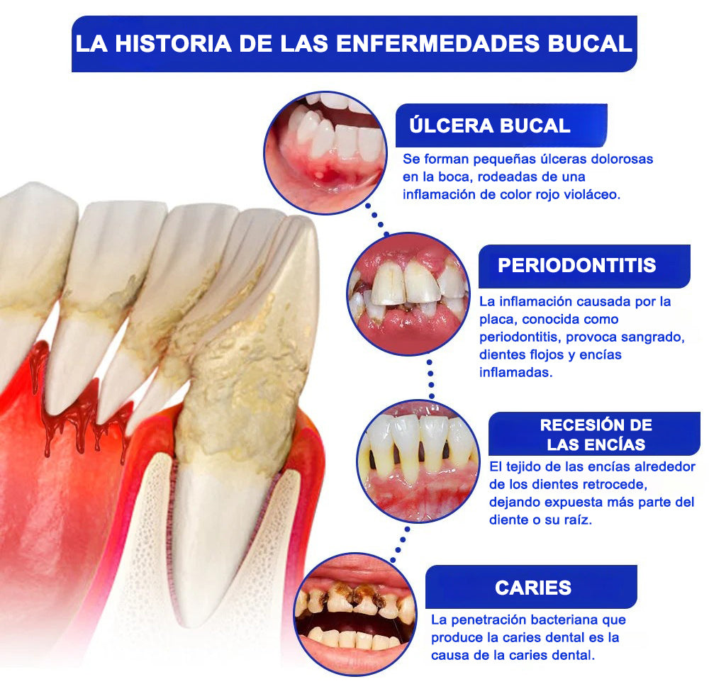 Dobshow® Microgránulos Dentales de Veneno de Abeja (🇲🇽 🦷 Aprobado)
