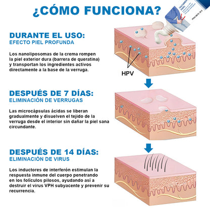 Cvreoz® Crema Alivio Verrugas Genitales VPH