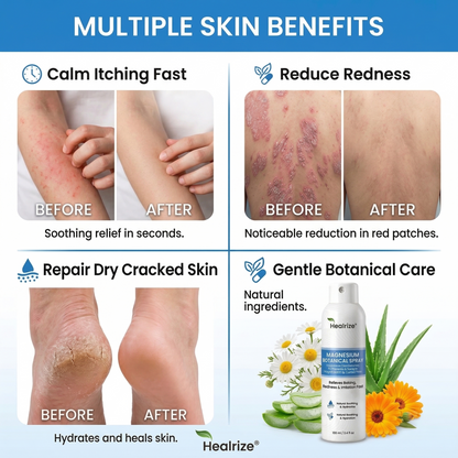 ✅ 𝙊𝙛𝙛𝙞𝙘𝙞𝙖𝙡 𝙎𝙩𝙤𝙧𝙚 | Healrize® Magnesium Botanical Spray – Advanced Skin Recovery for Psoriasis & Eczema | Rapid Soothing, Steroid-Free