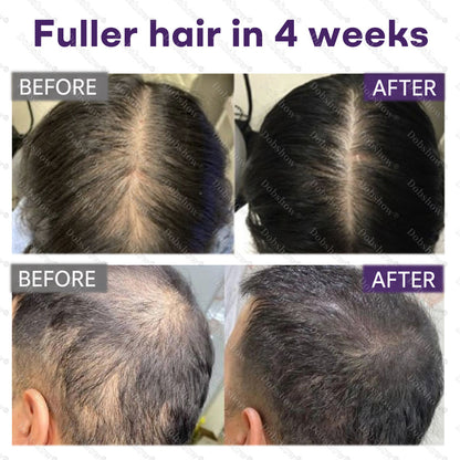 🔥Dobshow® Black Rice & Red Onion Hair Growth Spray