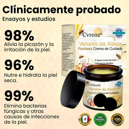 Cvreoz® Veneno de Abeja Psoriasis Crema de Cuidado