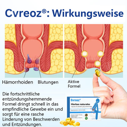 Cvreoz® Hierbas naturales Cápsulas de almidón para hemorroides