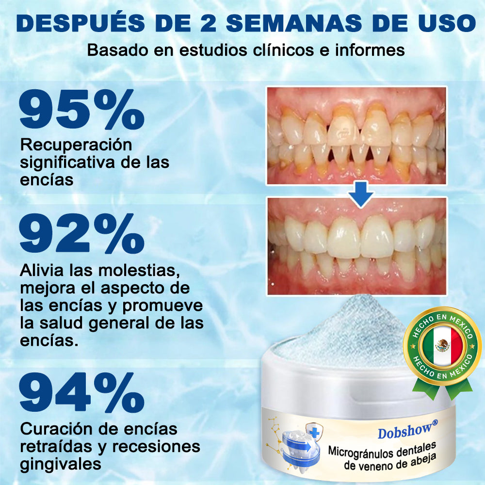 Dobshow® Microgránulos Dentales de Veneno de Abeja (🇲🇽 🦷 Aprobado)