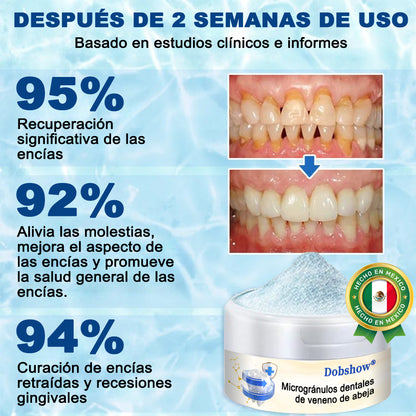 Dobshow® Microgránulos Dentales de Veneno de Abeja (🇲🇽 🦷 Aprobado)