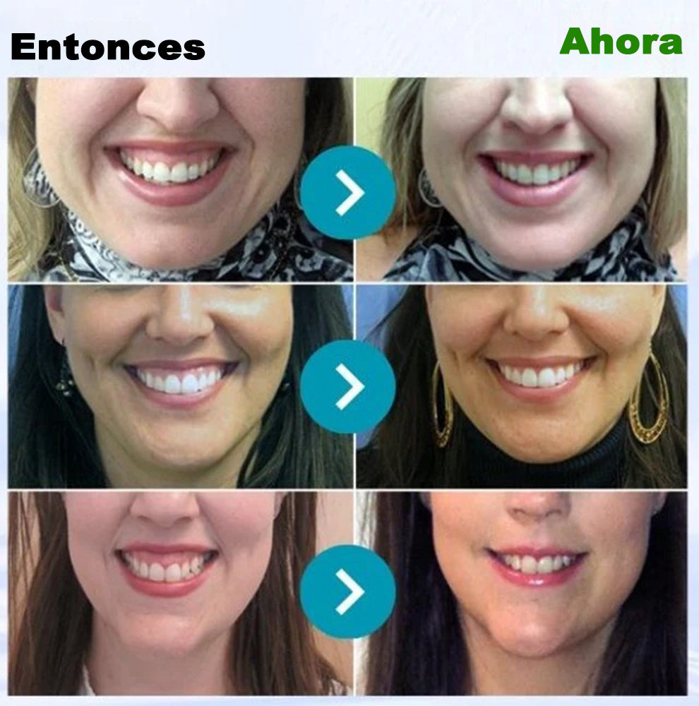 Dobshow® Microgránulos Dentales de Veneno de Abeja (🇲🇽 🦷 Aprobado)