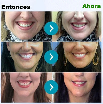 Dobshow® Microgránulos Dentales de Veneno de Abeja (🇲🇽 🦷 Aprobado)