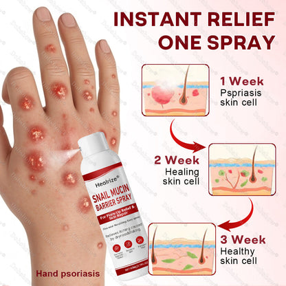 Healrize® Snail Mucin Barrier Spray for Flare-Up Relief & Skin Repair