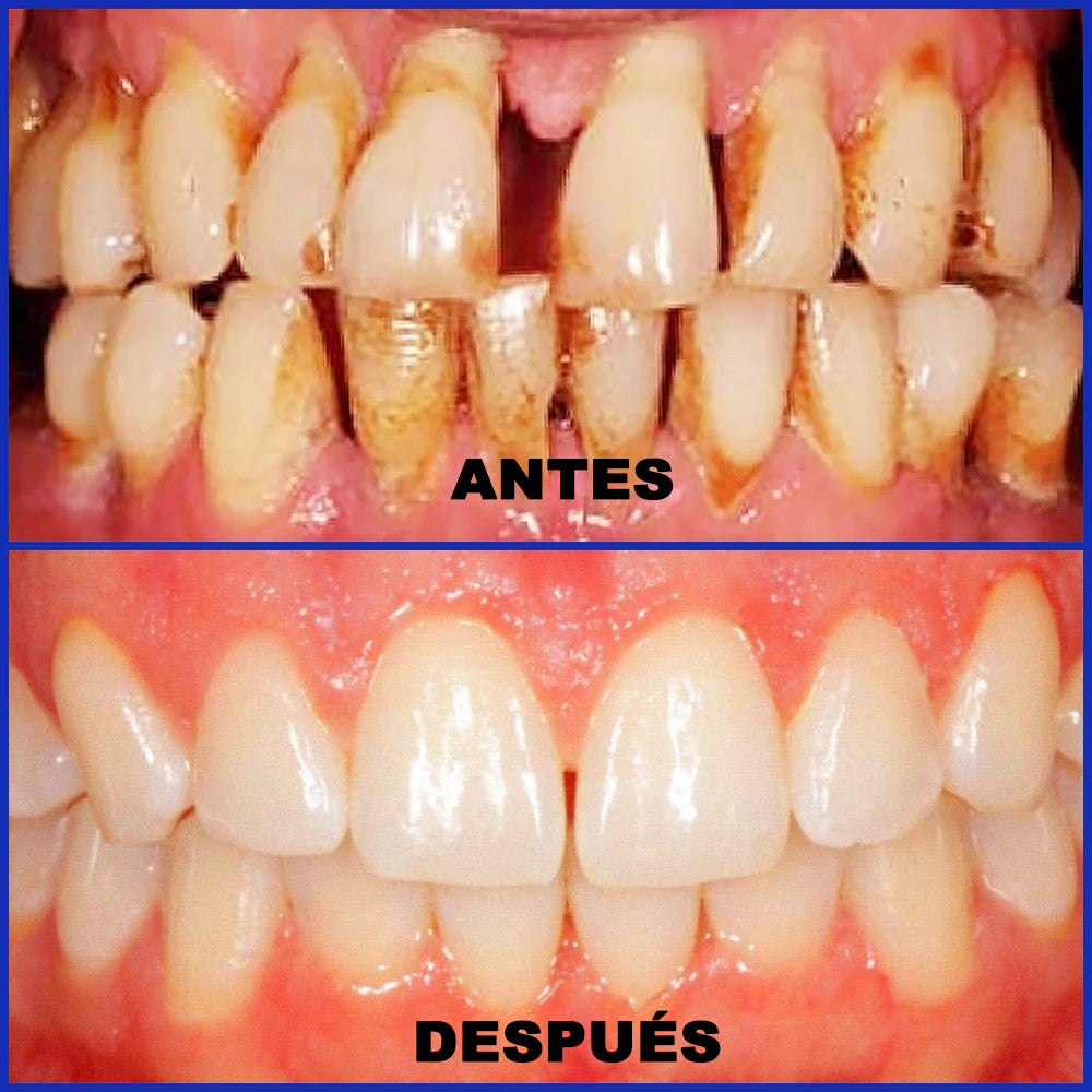 Dobshow® Microgránulos Dentales de Veneno de Abeja (🇲🇽 🦷 Aprobado)
