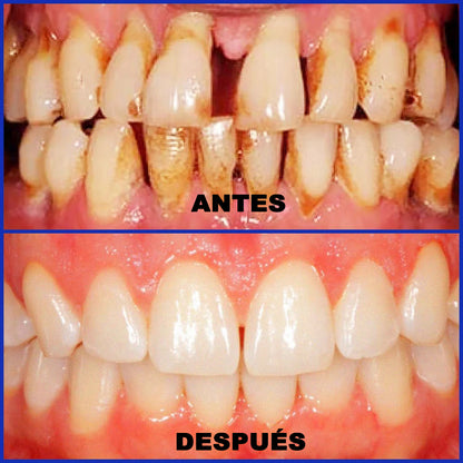 Dobshow® Microgránulos Dentales de Veneno de Abeja (🇲🇽 🦷 Aprobado)