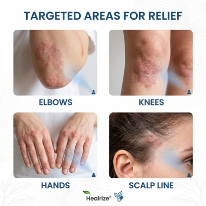 ✅ 𝙊𝙛𝙛𝙞𝙘𝙞𝙖𝙡 𝙎𝙩𝙤𝙧𝙚 | Healrize® Magnesium Botanical Spray – Advanced Skin Recovery for Psoriasis & Eczema | Rapid Soothing, Steroid-Free