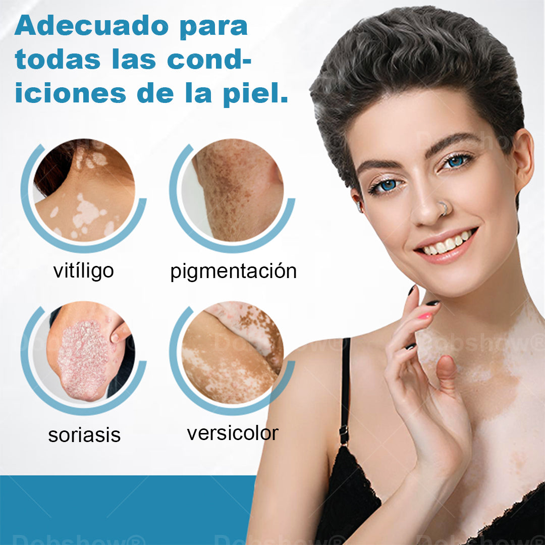 Nurbini® DermaBeam Instrumento para el tratamiento del vitíligo