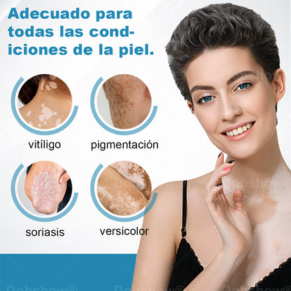 Nurbini® DermaBeam Instrumento para el tratamiento del vitíligo