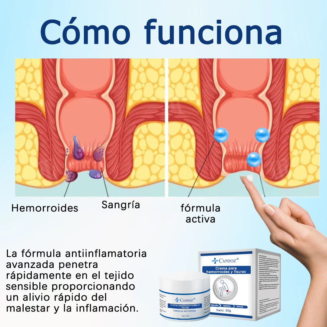 Cvreoz® Crema para hemorroides y fisuras