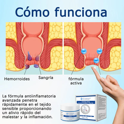 Cvreoz® Crema para hemorroides y fisuras
