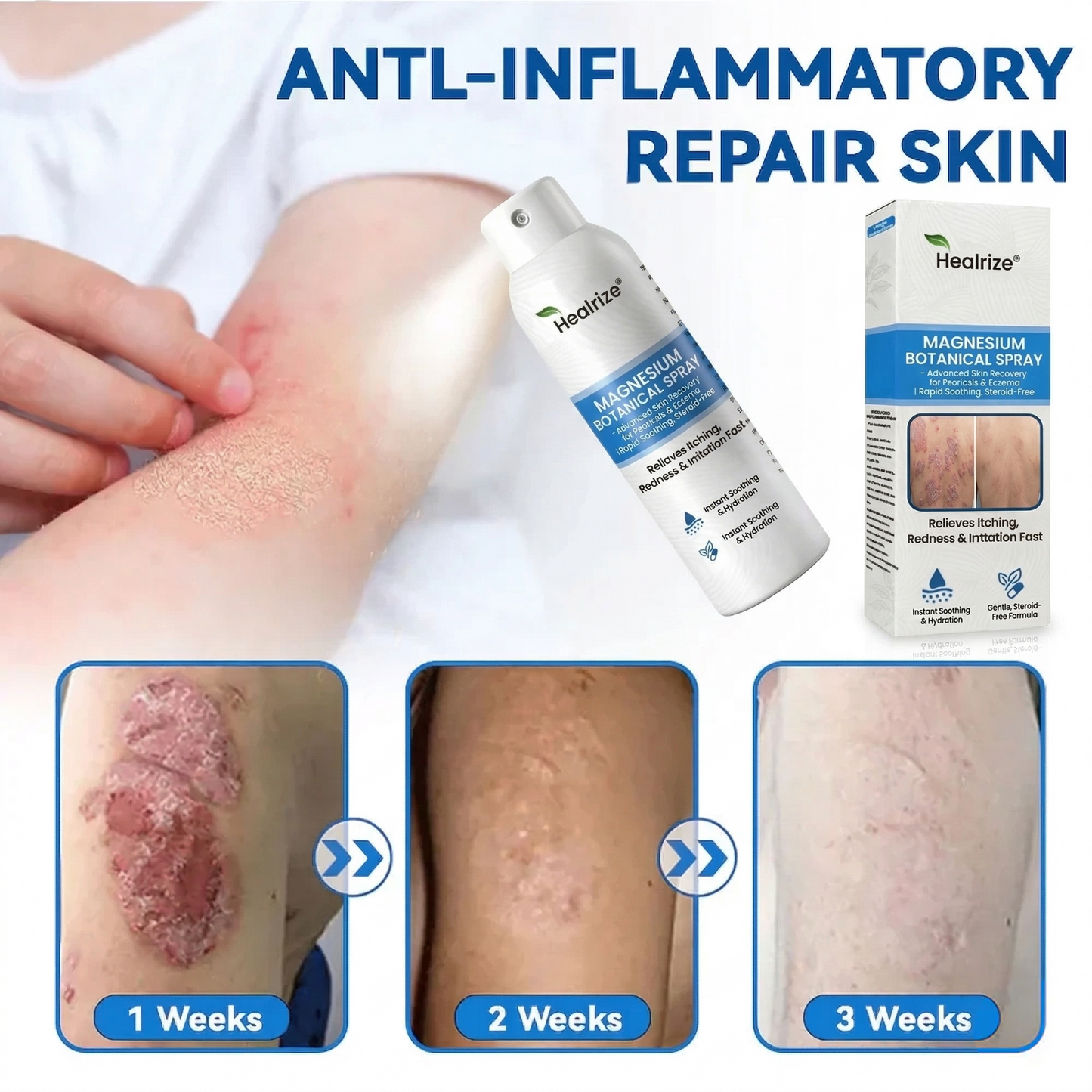 ✅ 𝙊𝙛𝙛𝙞𝙘𝙞𝙖𝙡 𝙎𝙩𝙤𝙧𝙚 | Healrize® Magnesium Botanical Spray – Advanced Skin Recovery for Psoriasis & Eczema | Rapid Soothing, Steroid-Free
