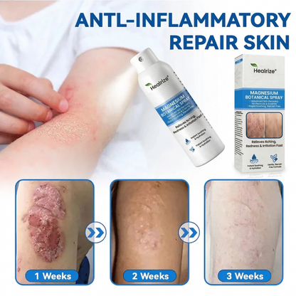✅ 𝙊𝙛𝙛𝙞𝙘𝙞𝙖𝙡 𝙎𝙩𝙤𝙧𝙚 | Healrize® Magnesium Botanical Spray – Advanced Skin Recovery for Psoriasis & Eczema | Rapid Soothing, Steroid-Free