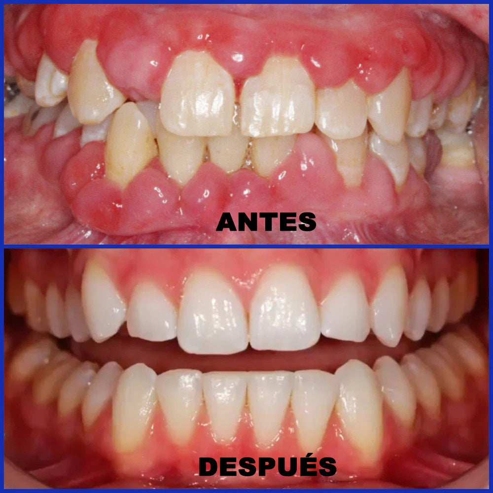 Dobshow® Microgránulos Dentales de Veneno de Abeja (🇲🇽 🦷 Aprobado)