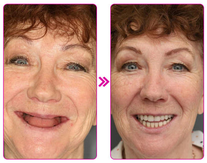 Dobshow® Thermoplastic Denture Adhesive